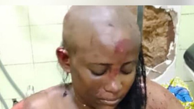 Insécurité à Libreville : une jeune femme victime d’une agression violente