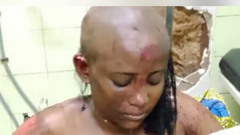 Insécurité à Libreville : une jeune femme victime d’une agression violente