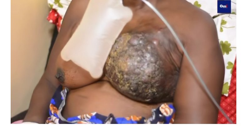 Cancer du sein :  une femme en détresse lutte pour sa survie à Port-Gentil